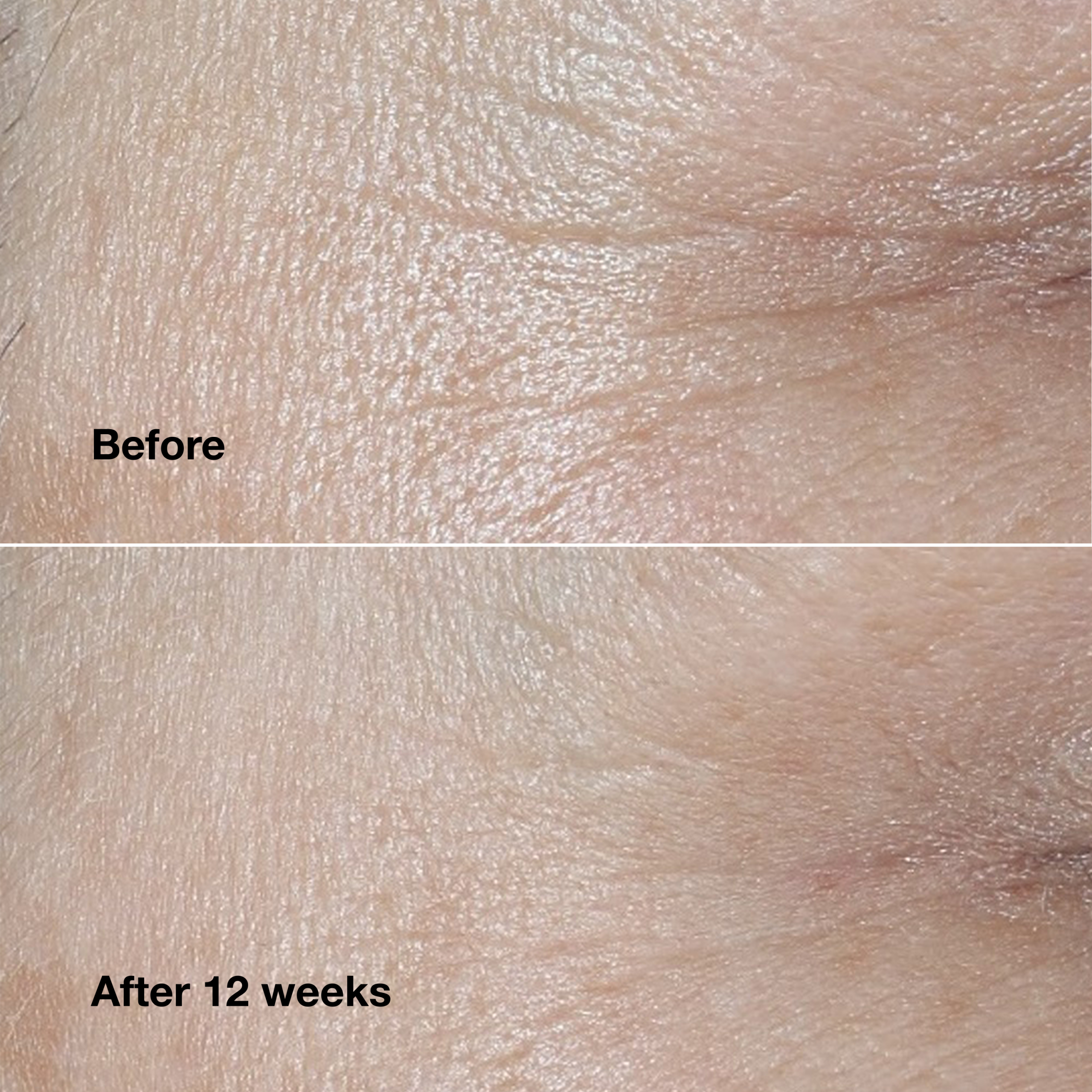 Clinique Smart Clinical Repair? Wrinkle Correcting Cream