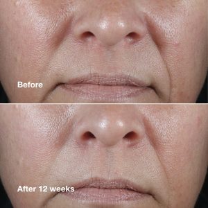 Clinique Smart Clinical Repair? Wrinkle Correcting Rich Cream