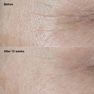 Clinique Smart Clinical Repair? Broad Spectrum SPF 30 Wrinkle Correcting Cream