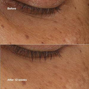 All About Eyes? Brightening Serum Concentrate