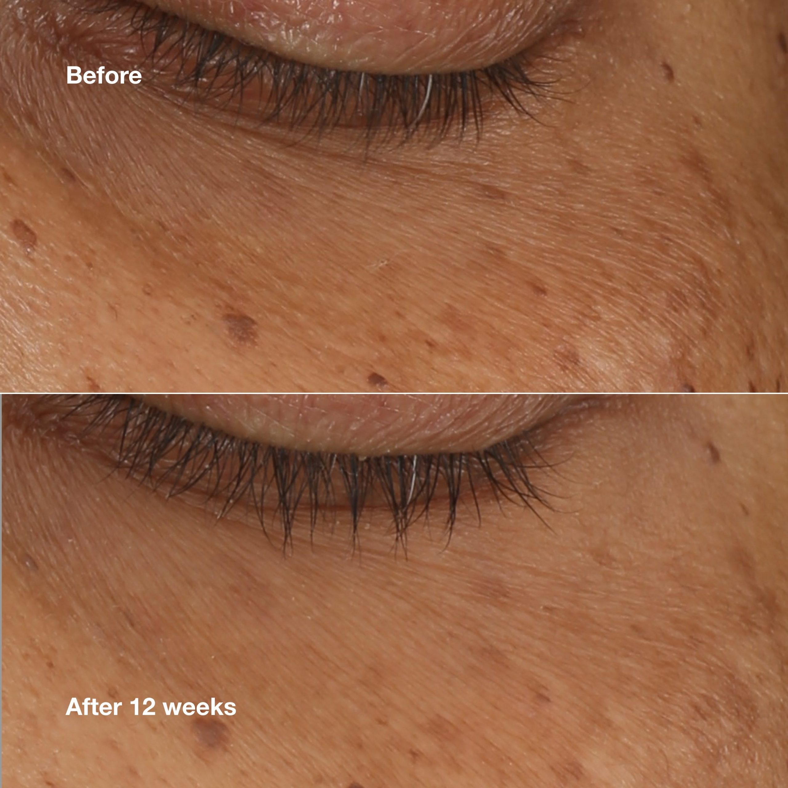 All About Eyes? Brightening Serum Concentrate