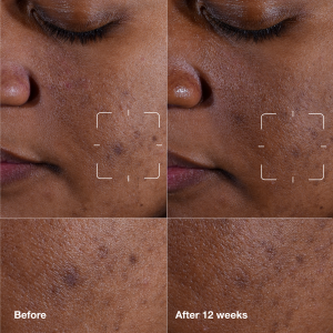 Even Better Clinical? Dark Spot Clearing Serum