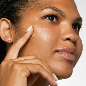 Acne Solutions? Clinical Clearing Gel