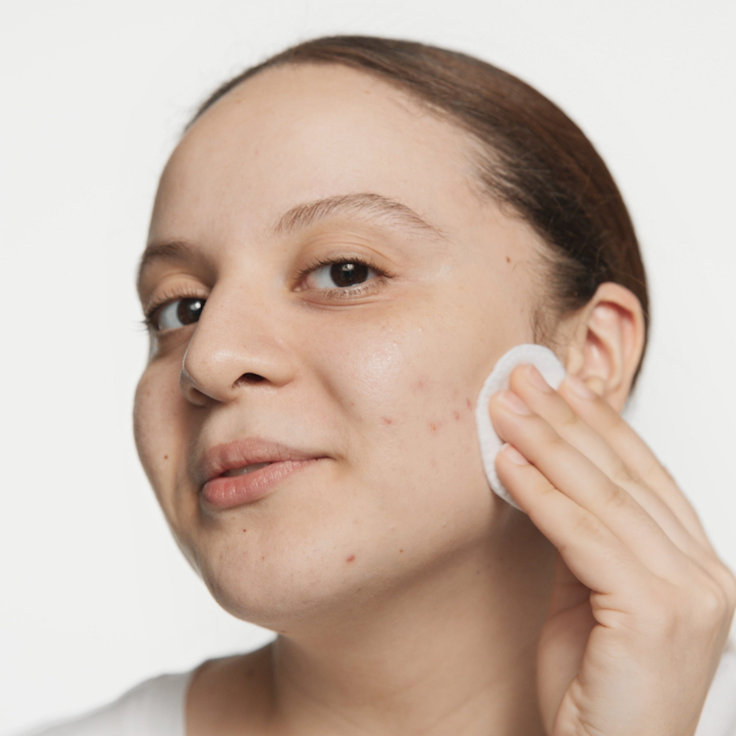 Acne Solutions? Clarifying Lotion - Image 2