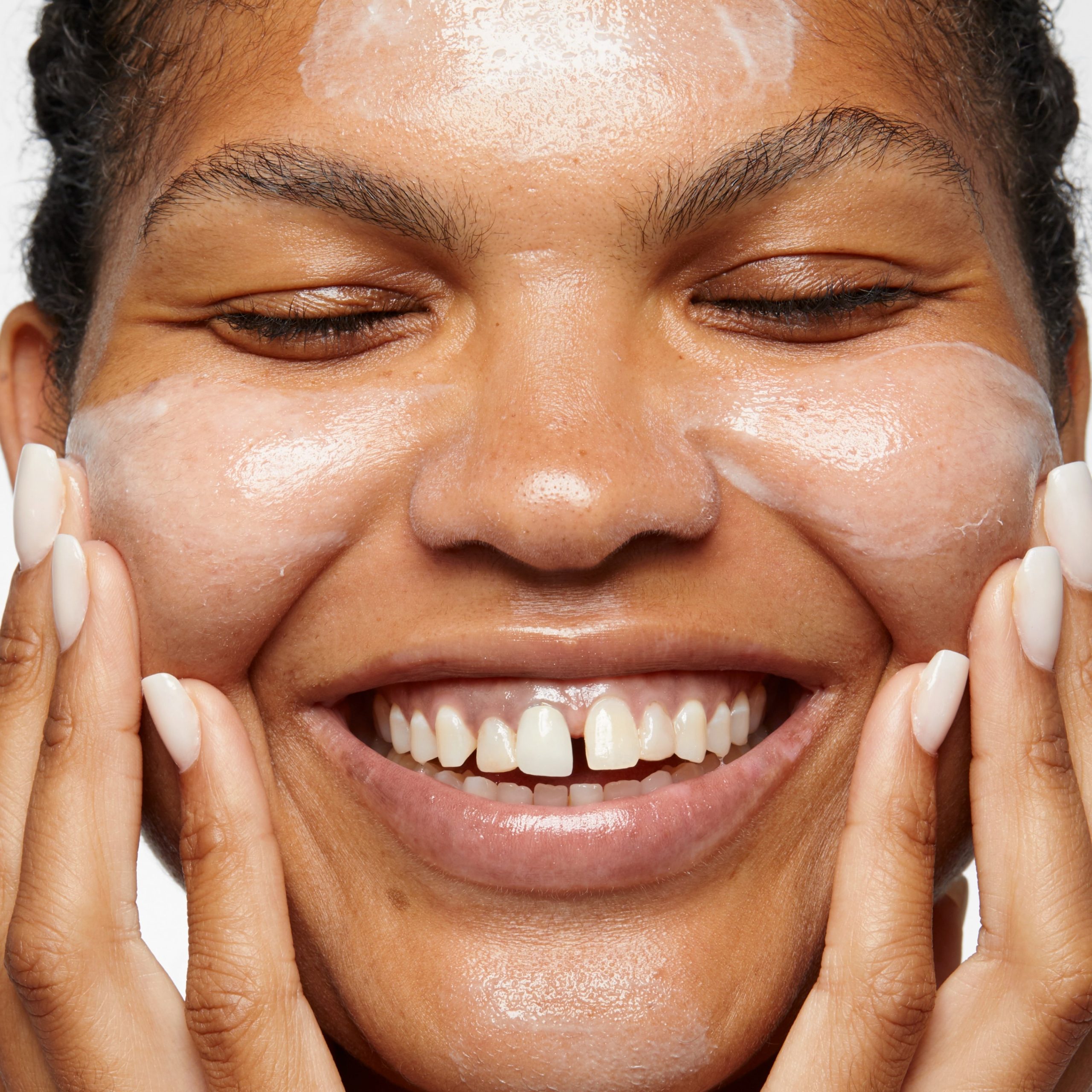 Acne Solutions? All-Over Clearing Treatment - Image 3