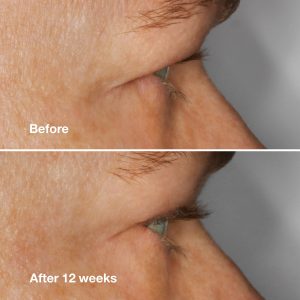High Impact? Lash Amplifying Serum