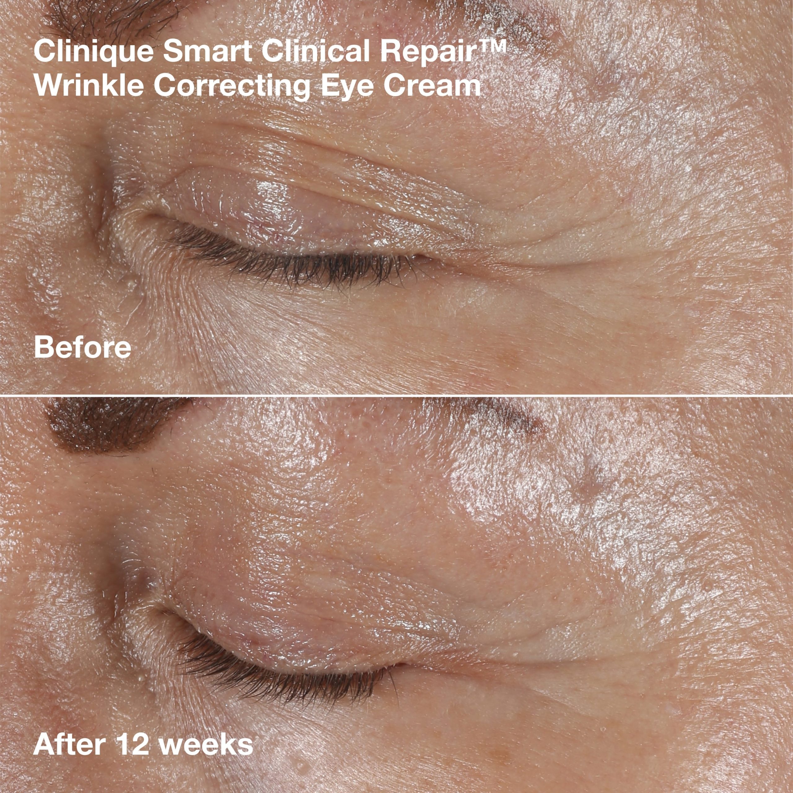 De-Aging Duo - VGL7Y6 - Image 9