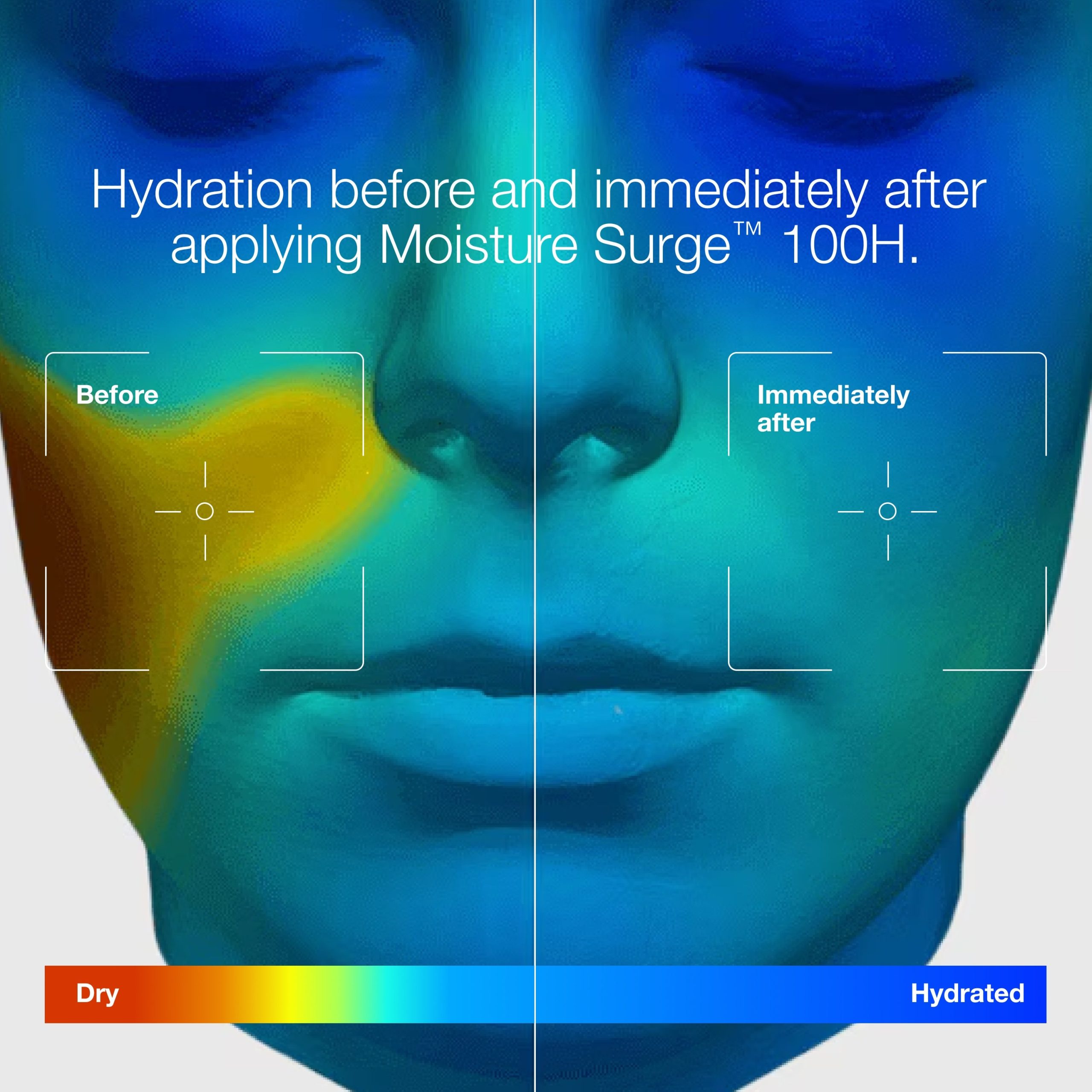 All-Around Hydration Skincare Set - Image 7